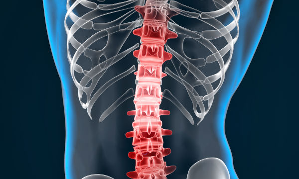 Espondilitis Anquilosante más que un simple dolor de espalda