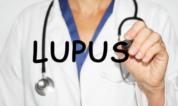 Día Mundial del Lupus Eritematoso Sistémico (LES), 10 mayo 2